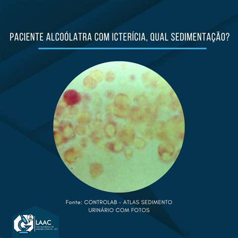  Woronichinia: Um Parasita Microscópico que Faz da Suas Vítimas Seu Lar!