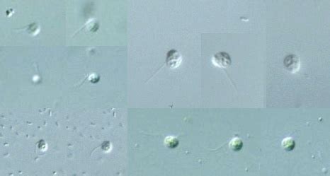  Heteromita! Um Protista Mastigoforo que Você Provavelmente Nunca Ouviu Falar