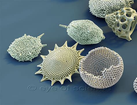  Radiolarians Uma Visão Microscópica Deslumbrante dos Unicelulares Marinhos com Formas Geométricas Exquisitas!