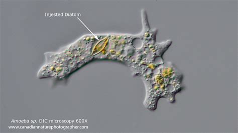  Sideramoeba! Um Protista Intrigante Que Vive Entre os Grãos de Areia